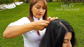 ASMR NELSY - Special 18 Minutes Hair Cracking (Sacar los soles)