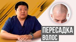 Пересадка волос. Облысение у мужчин. Как проводится? До и после.