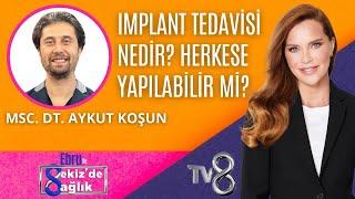 IMPLANT TEDAVİSİ NEDİR? HERKESE YAPILABİLİR Mİ? | MSC. DT. AYKUT KOŞUN | 8'de Sağlık