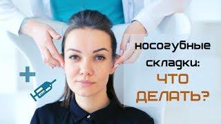 Носогубные складки: как убрать и почему разная стоимость? Коррекция филлерами, до после