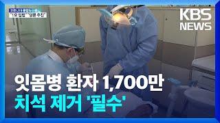 ‘양치로는 부족’ 잇몸병 환자 1,700만…치석 제거 필수 / KBS  2022.06.13.