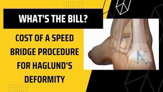 Speed Bridge procedure price for Haglund's Deformity