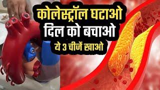 कोलेस्ट्रॉल घटाओ दिल को बचाओ ये 3 चीजें खाओ Dr Mukul Saldi BAMS, MD AM ,CFN