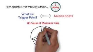 What is a trigger point - trigger points explained