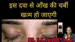 आँख की चर्बी 10 दिन में गल जायेगी /xanthelasma की सबसे अच्छी दवा  Dr. s.k.pandey M.D.