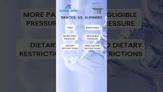 Braces vs Aligners | Invisalign Providers and Orthodontists | AK Global Dent | Learn More