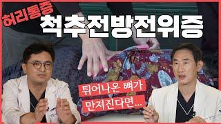 아직도 허리 통증에는 디스크 협착증만 생각하시나요? 중년 여성에게 유독 잘 나타나는 3대 척추질환! 척추전방전위증!!