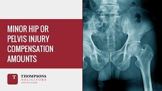 Minor Hip or Pelvis Injury Compensation Amounts