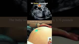 32 week pregnancy ultrasound showing inside the womb