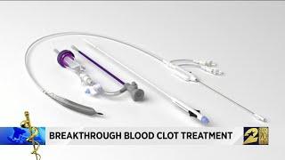 Breakthrough blood clot treatment