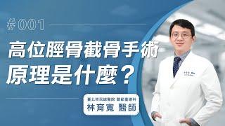 【高位脛骨截骨手術Q&A】手術的原理是什麼？│林育寬醫師