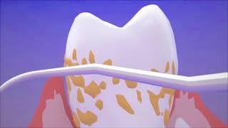 Say Goodbye to Gingival Flap Surgery