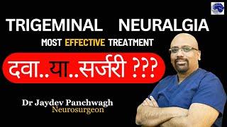 Most effective Trigeminal Neuralgia Treatment. Dr Jaydev Panchwagh