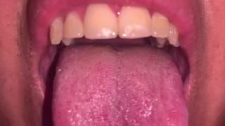 Look my teeth and my uvula | Mis dientes y mi campanilla   | MOUTH VORE #uvula #teeth