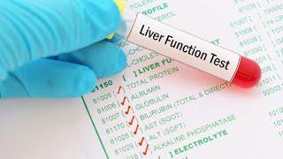 LFT,s|| Liver function test|| Liver enzymes|| medical Laboratory|| Diagnosing of liver disease||