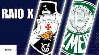 RAIO X - VASCO X PALMEIRAS - QUEM É MELHOR - com @portao_9