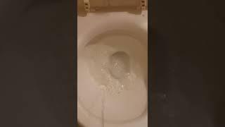 Foam in Urine