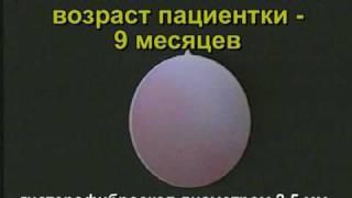 Детская гинекология. Вагиноскопия.