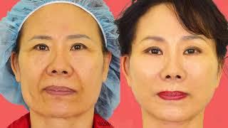 KJ Gets a FACELIFT at WAVE Plastic Surgery! (AMAZING)