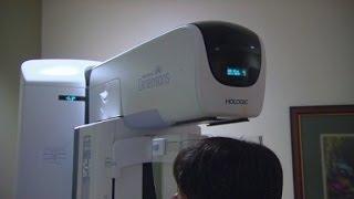 3D Mammograms