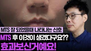 【MTS 효과를 본 증거】 mts 효과나게 하는 방법 3가지