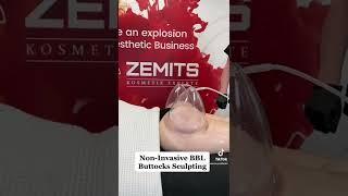 Non-Invasive BBL Buttocks Sculpting with Vacuum Cupping body remodeling system and XXL vacuum cups