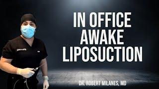 Awake Liposuction of Outer Thighs| Short