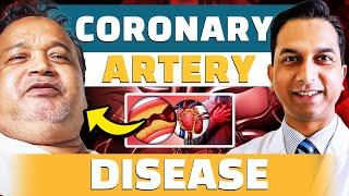 Successful Angioplasty Story | Coronary Artery Disease | Heart Disease Symptoms | Dr. Vivek Kumar