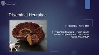 Briefly explained: Trigeminal Neuralgia