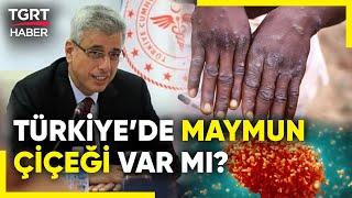 Dünya Alarmda! Türkiye'de Maymun Çiçeği Vakası Var Mı? Sağlık Bakanı Açıkladı - TGRT Haber