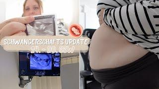 SCHWANGERSCHAFTS UPDATE 4-5 MONAT| DER KLEINE WIRD IMMER AKTIVER | ULTRASCHALL🩵 | Vanessa Nicole