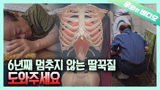 잘 수도 먹을 수도 없게 하는 공포의 딸꾹질, 도와주세요┃Unstopping Hiccups for 6 Years, Threatening His Life