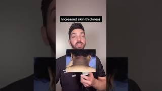 Darker Neck - DermDoctor Explains Acanthosis Nigricans #shorts