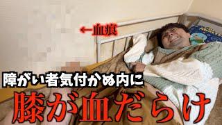 下半身麻痺の障がい者が睡眠中に膝を壁で傷つけてしまい気付かないまま血だらけに、、、