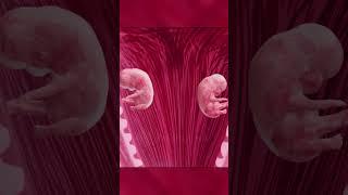 Twin wonders in mother's womb | Types of Twins | Twin baby pregnancy #twins #twinsbaby