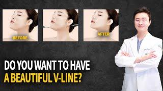 Face Liposuction | The most popular question!