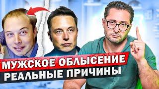 Мужское облысение. Что делать при выпадении волос? Причины и виды лечения.