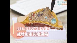 【乳癌症狀】粉紅10月：長期受雌激素影響　或增加患乳癌風險｜UL女性健康｜UrbanLife Health 健康新態度