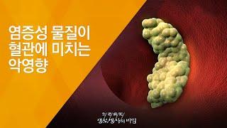 염증성 물질이 혈관에 미치는 악영향 - (2010.4.22_330회 방송)_만사혈통, 혈관 고속도로를 지켜라!