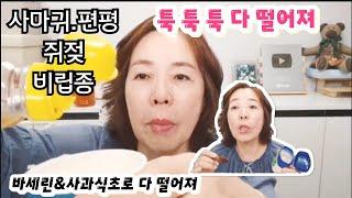 쥐젖 사마귀 편평사마귀 검버섯 바르고 자면 뚝 떨어지는 바세린&사과식초