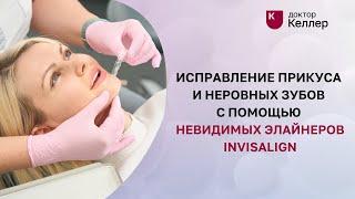 Исправление прикуса и неровных зубов с помощью невидимых брекетов Invisalign