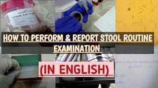 Stool Routine Examination & Reporting explained step by step in an easy way.Stool R/E.Stool analysis