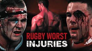 Brutal Rugby Injuries Ever | Rugby Knockouts