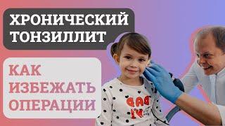 Хронический ТОНЗИЛЛИТ, ЭФФЕКТИВНОЕ лечение. БЕЗ ОПЕРАЦИИ.