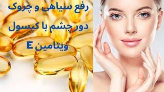 رفع سیاهی و چروک دور چشم: چطوری با کپسول ویتامین e سیاهی و چروک دور چشم رو برطرف کنیم#زیبایی#پوست