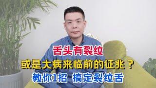 舌头有裂纹，或是大病来临前的征兆？教你1招，搞定裂纹舌！