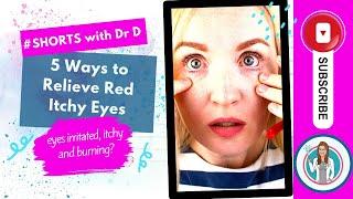 5 Ways to Relieve Red Itchy Eyes | 5 Tips to Cure Red Itchy Eyes | 5 Ways to Treat Red Itchy Eyes