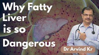 What is Fatty Liver?