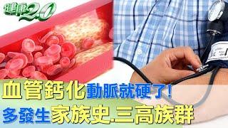 血管鈣化動脈就硬了! 多發生家族史.三高族群 健康2.0 @tvbshealth20