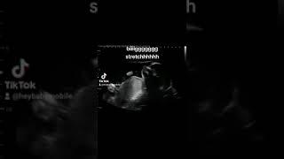 Baby Stretch at 25 Weeks 5 Days Pregnant on Ultrasound